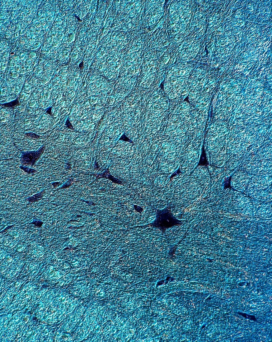 Human spinal cord,light micrograph