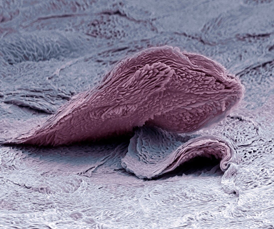 Skin cell,SEM