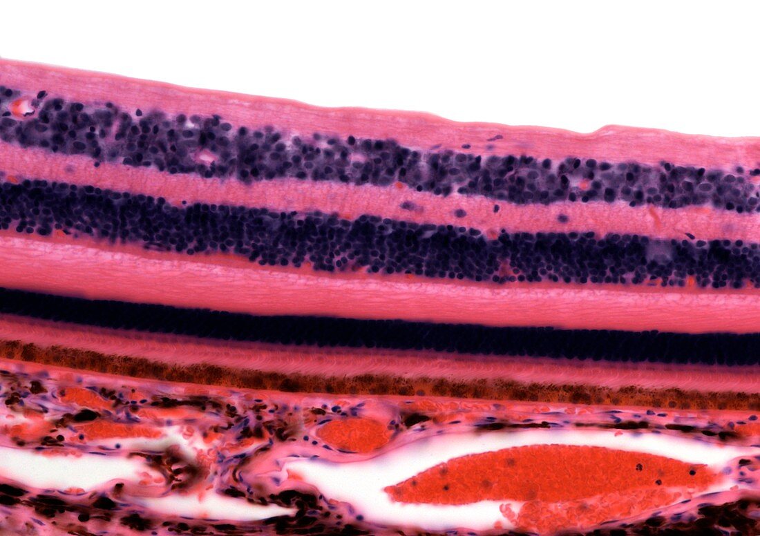 Retina,light micrograph