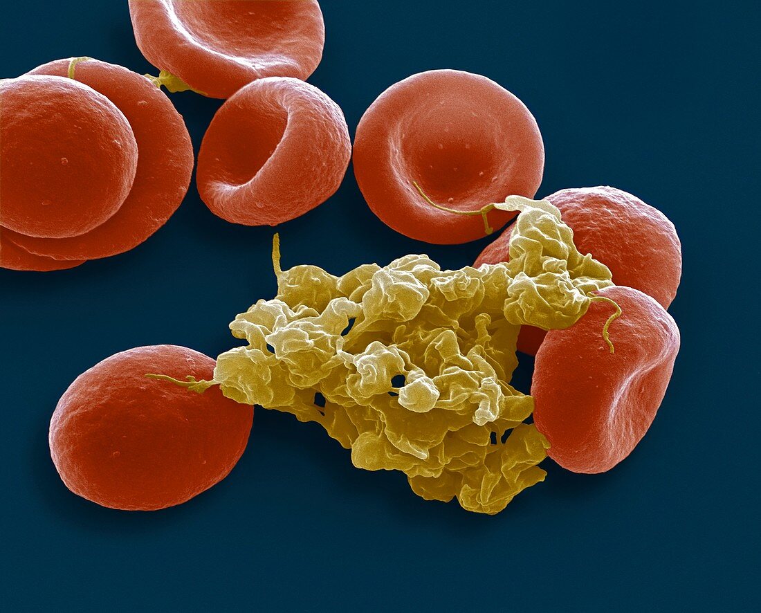 Blood cells,SEM
