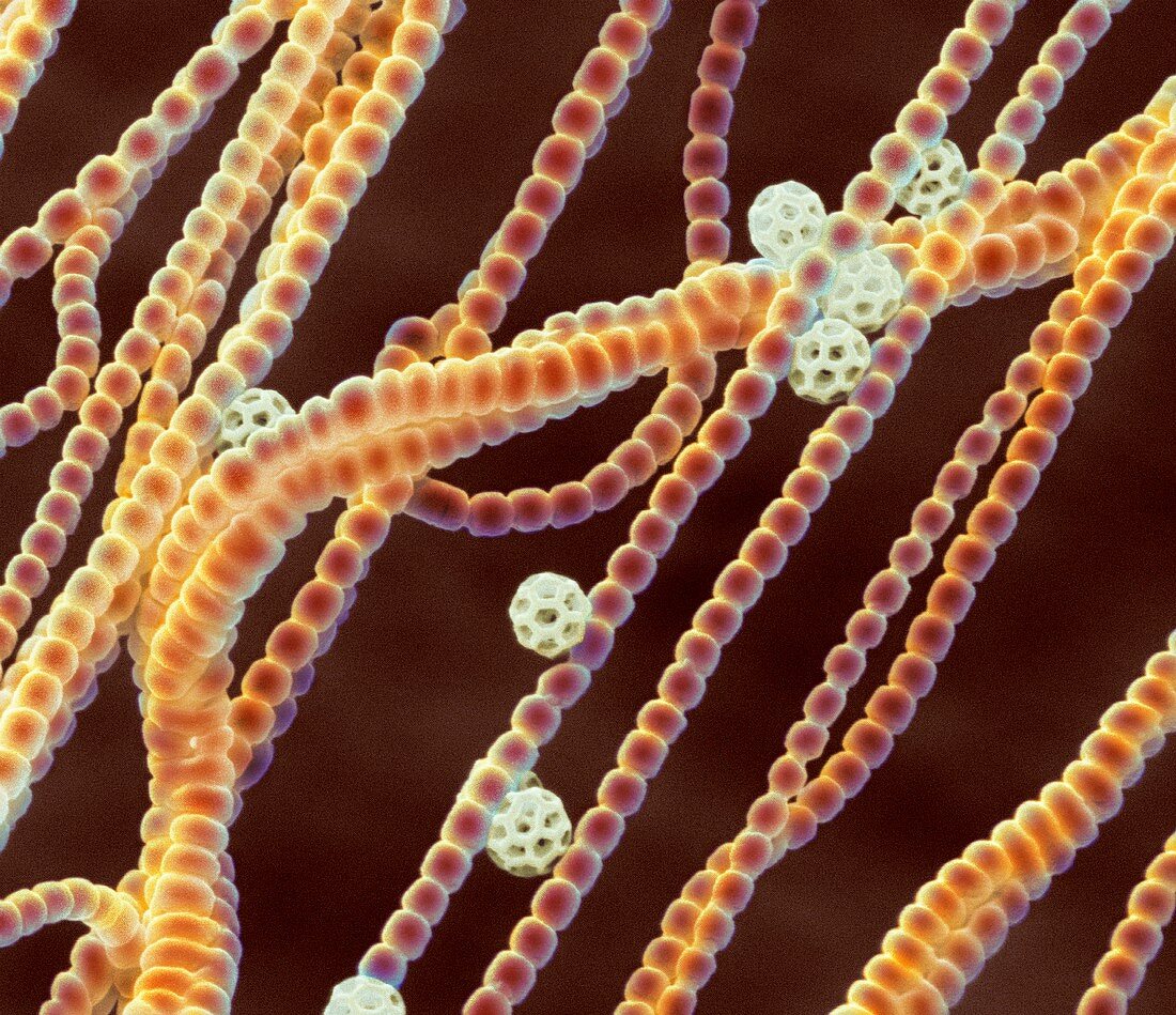 Pollen threads and brochosomes,SEM