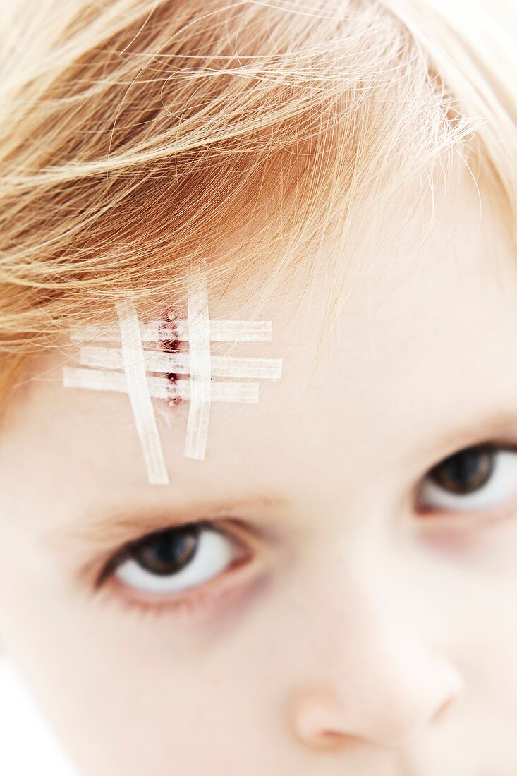 Young boy with head wound