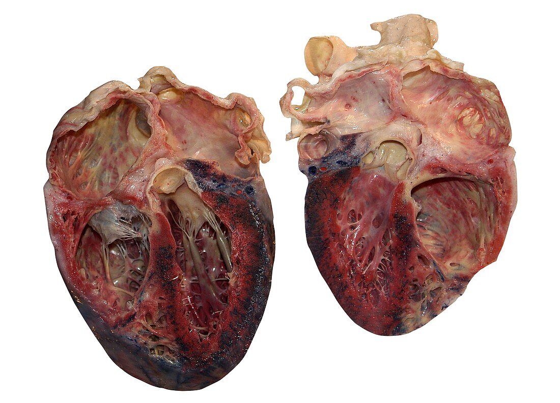 Dissected human heart