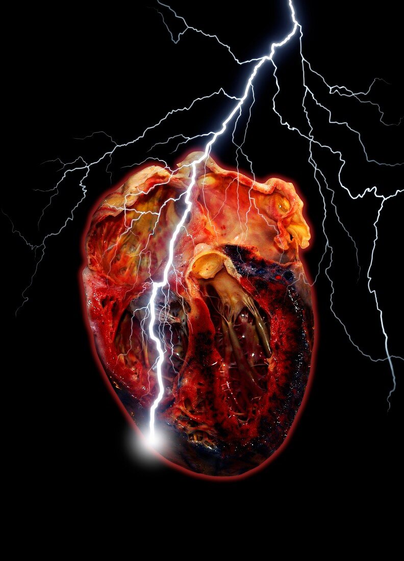 Heart attack,conceptual artwork