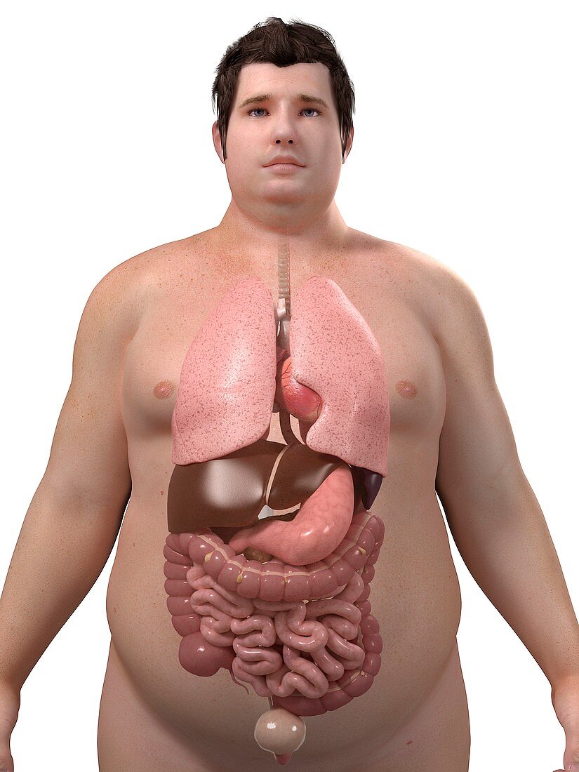Obese man's organs,artwork