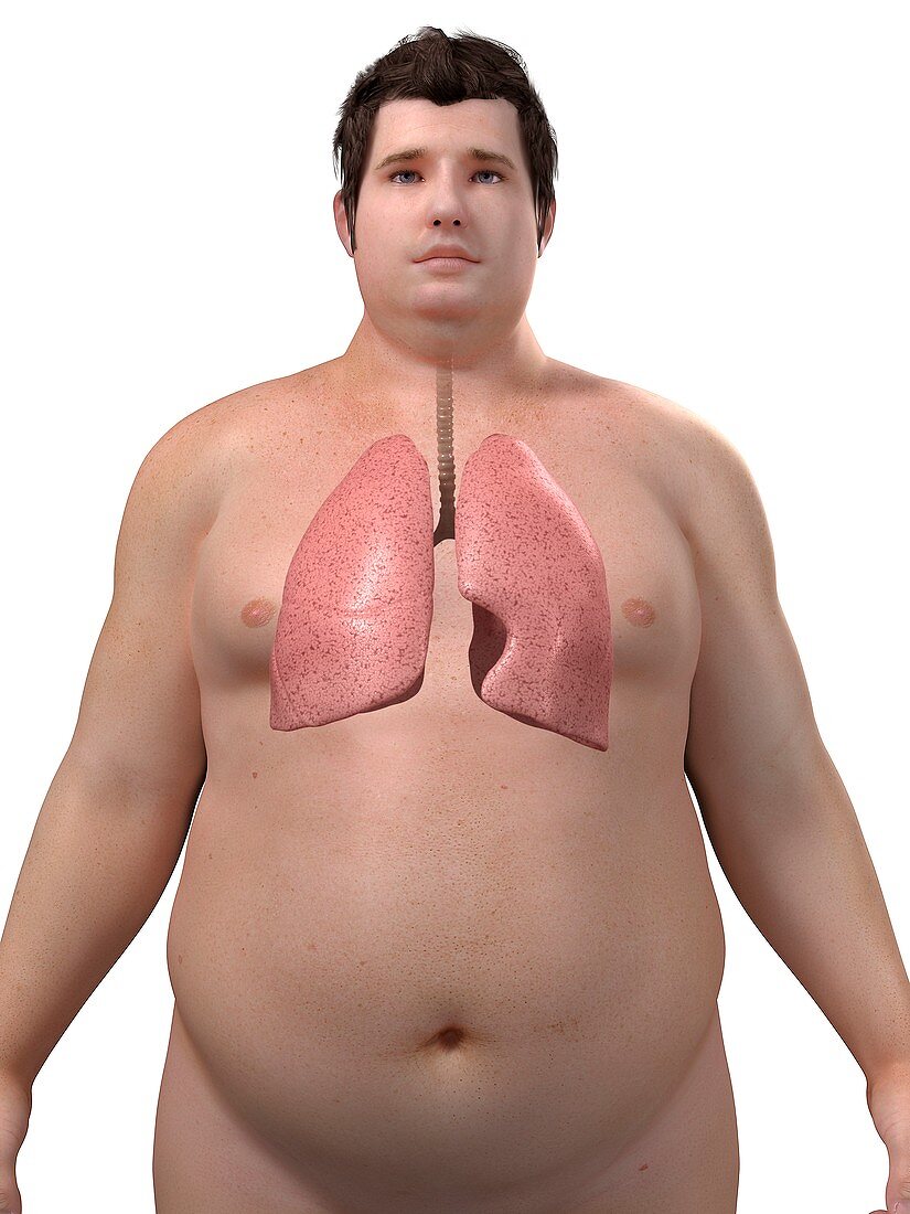 Obese man's lungs,artwork