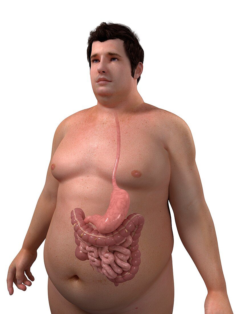 Obese man's digestive system,artwork