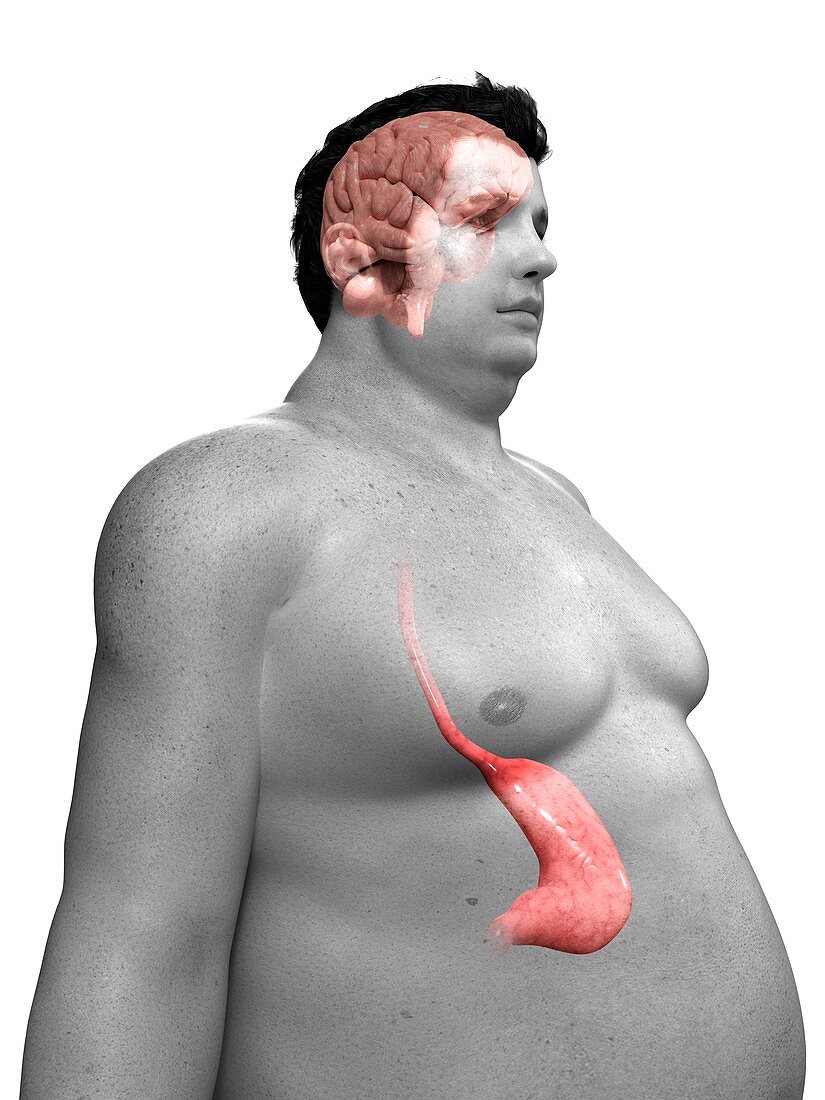 Obese man's stomach,artwork