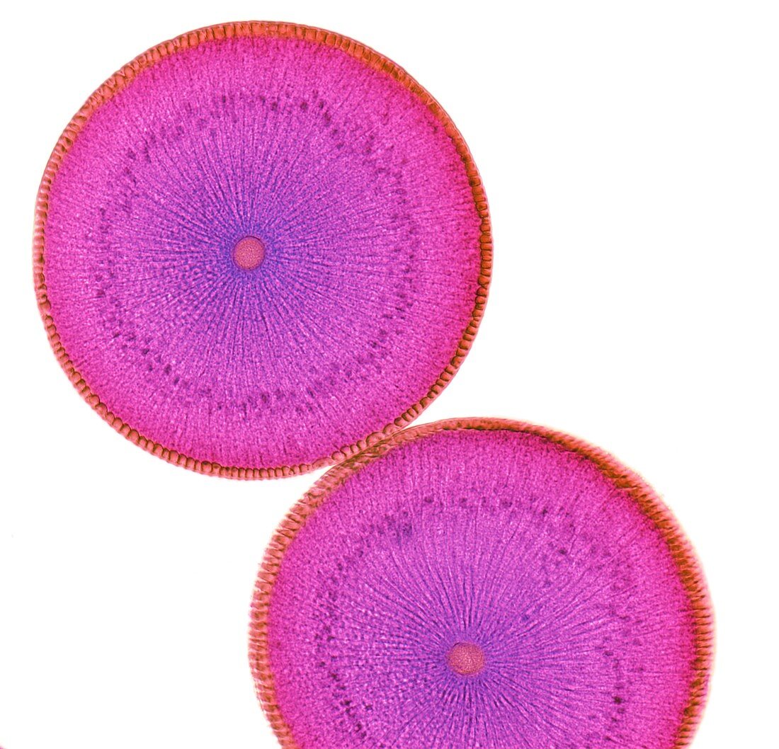 Roundworm ovaries,light micrograph