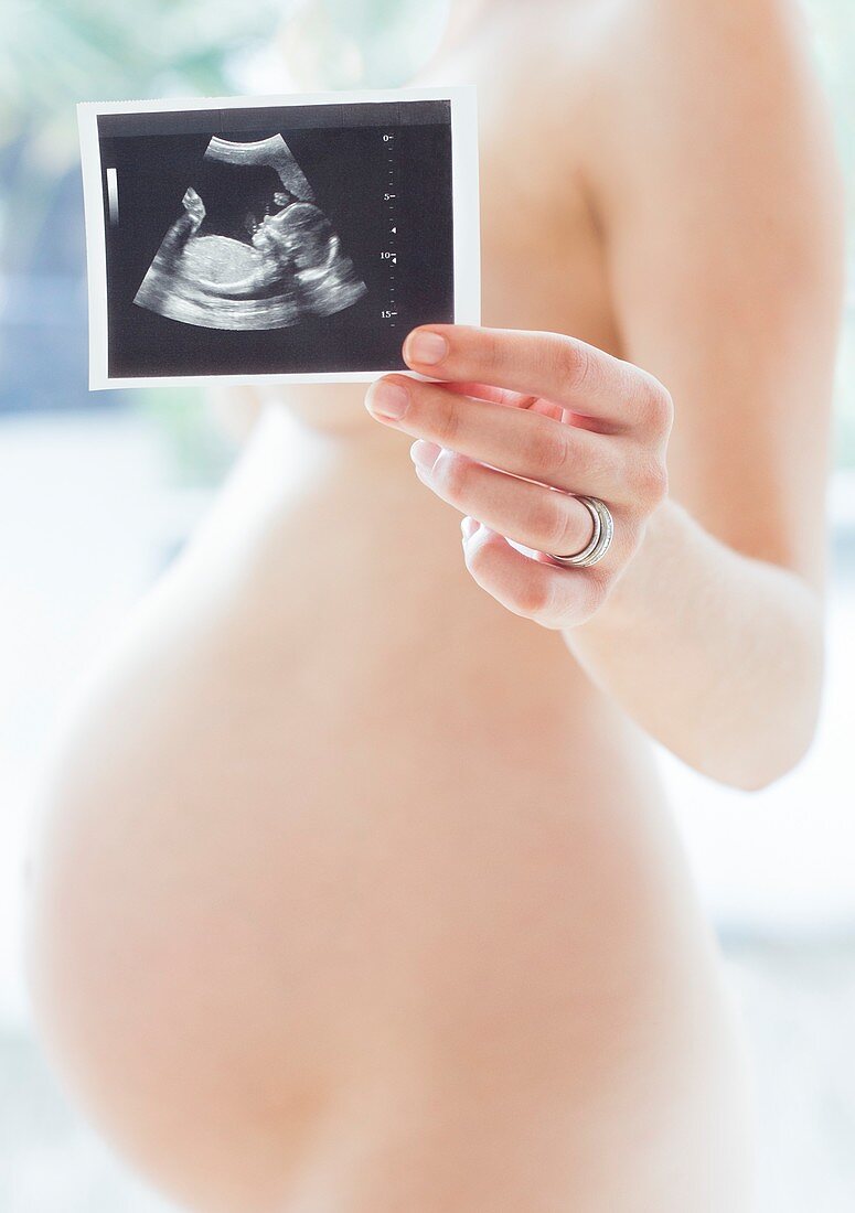 Pregnant woman and baby scan