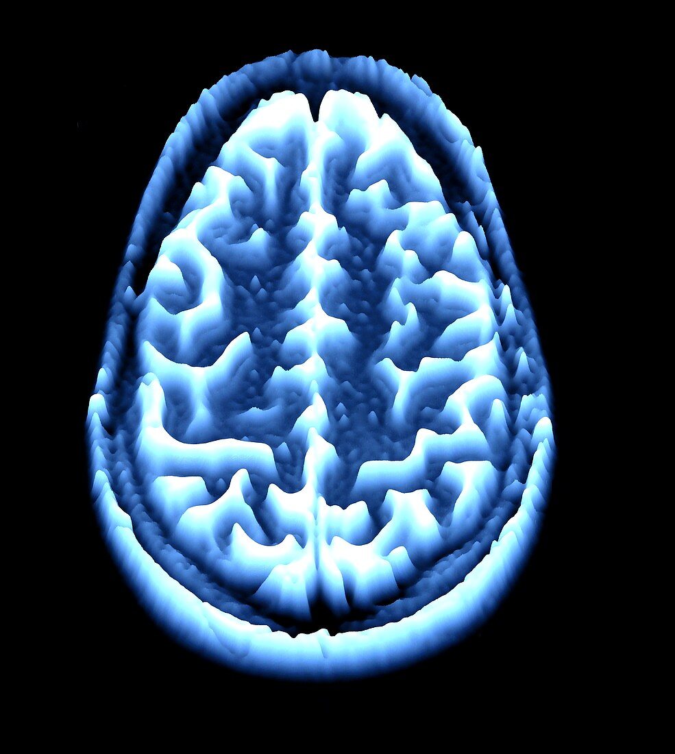 Brain scan,MRI scan,heightmap