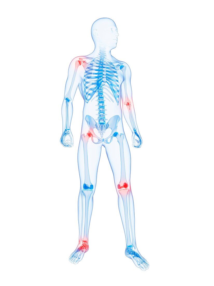 Joint pain,conceptual artwork