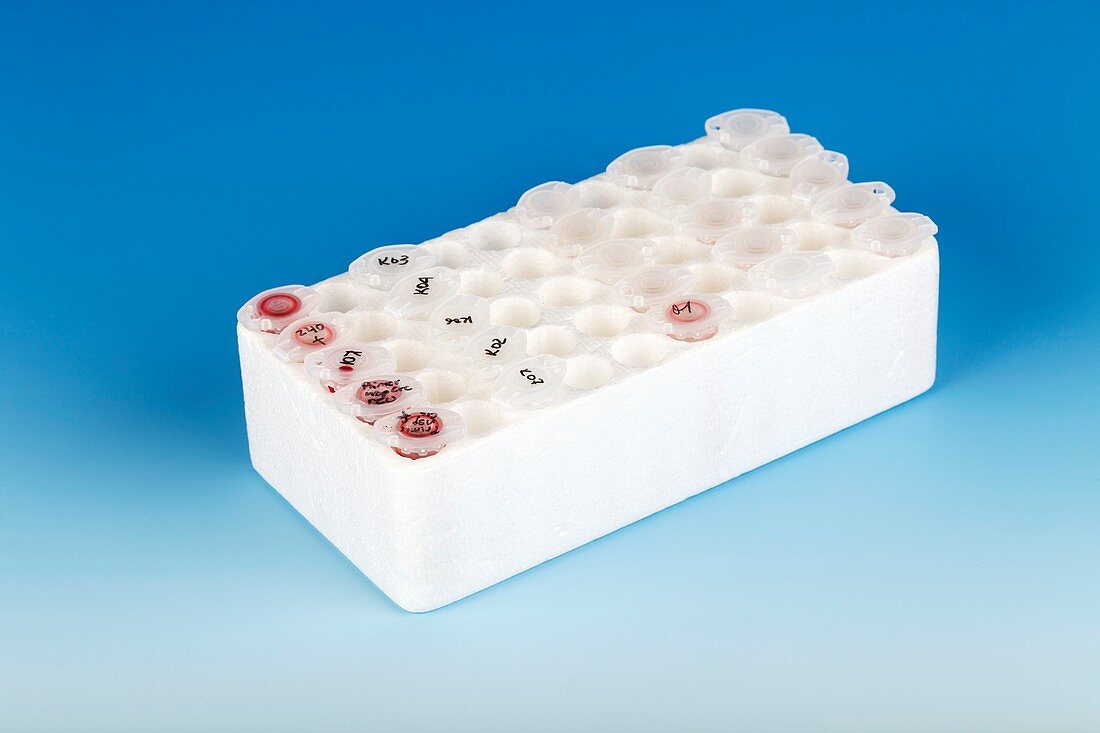 Eppendorf tubes in a rack