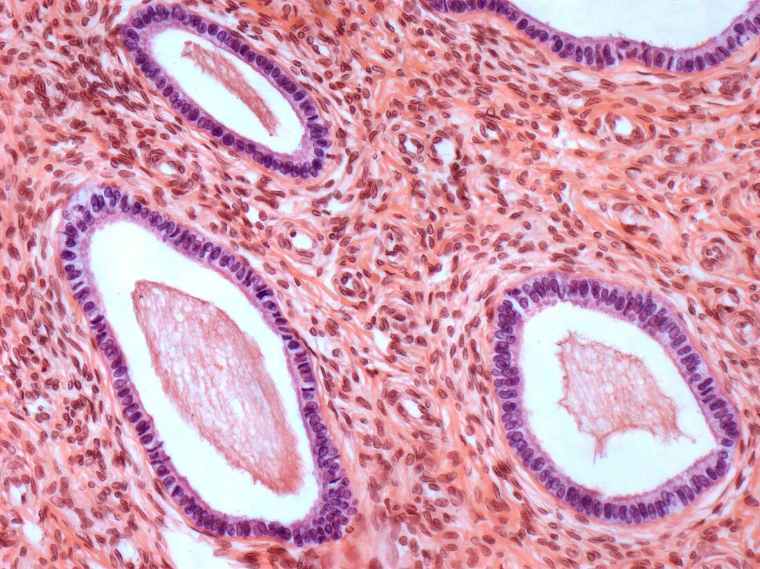 Cervix,light micrograph