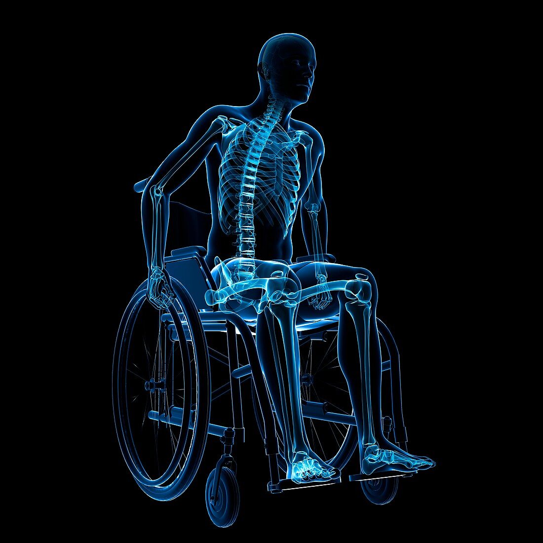 Man in a wheelchair,artwork