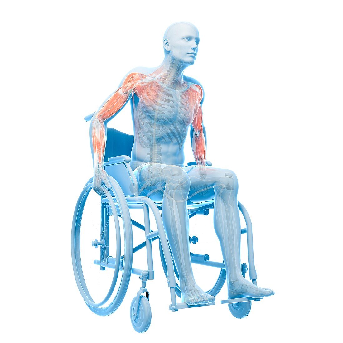 Man in a wheelchair,artwork