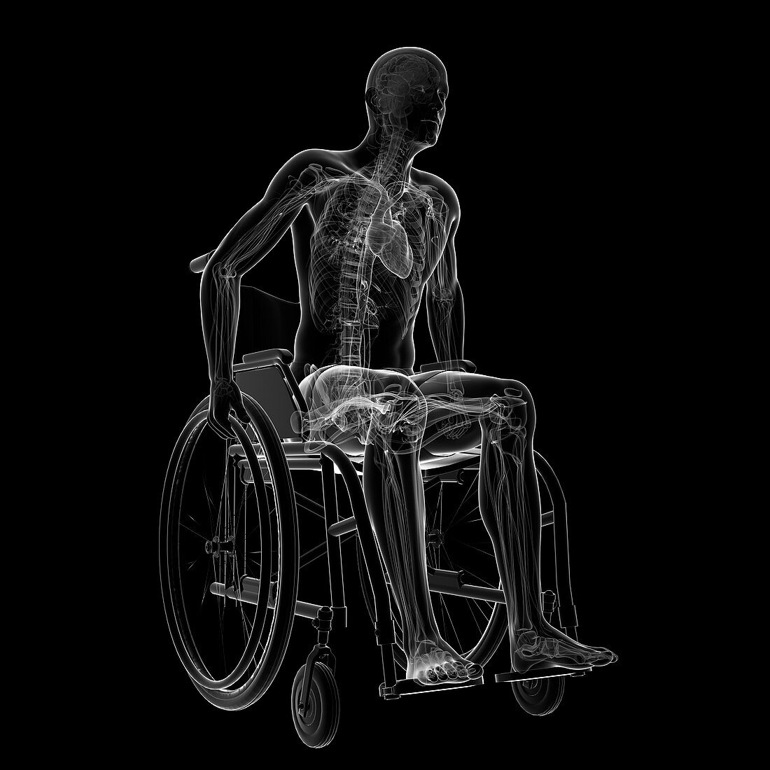 Man in a wheelchair,artwork