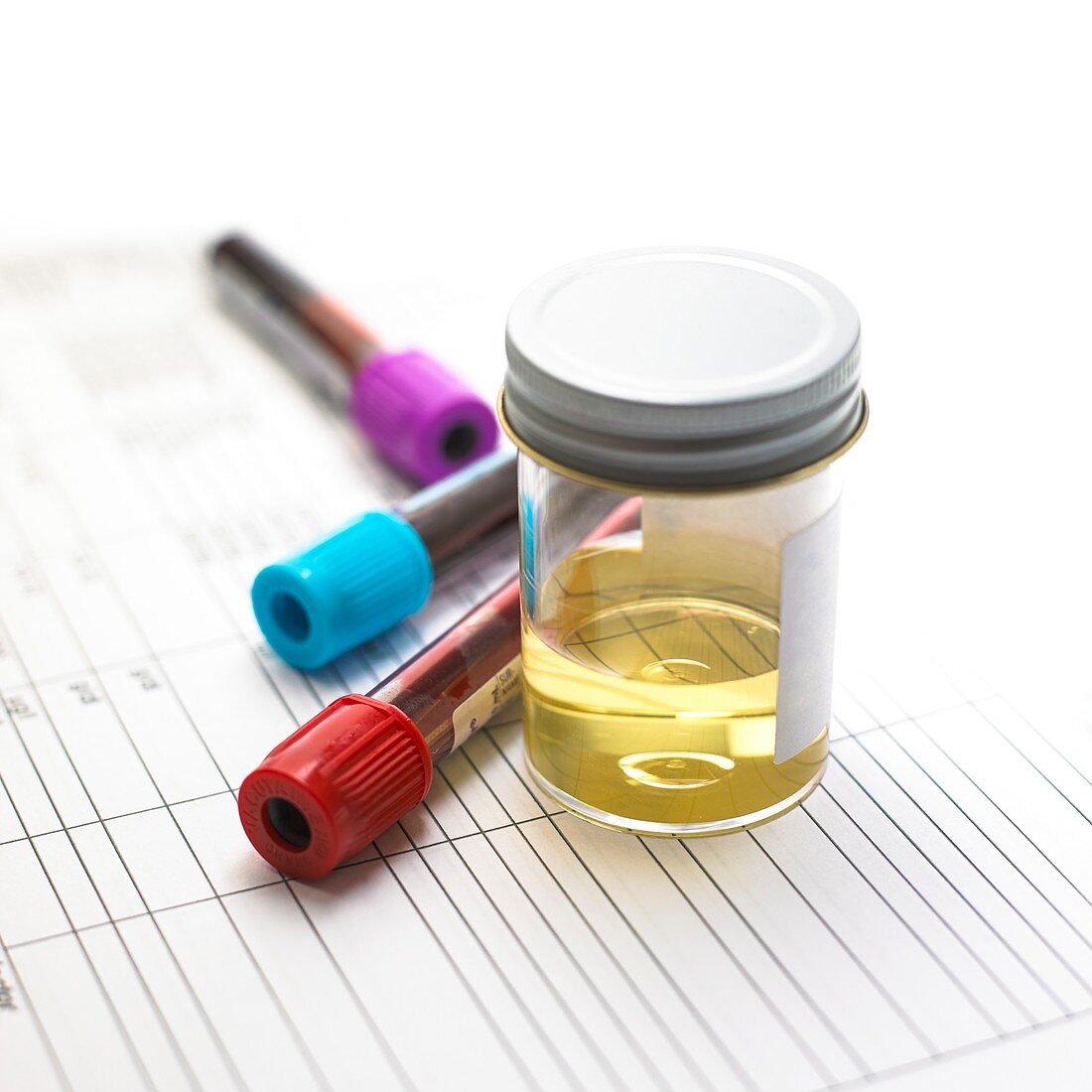 Urine and blood samples