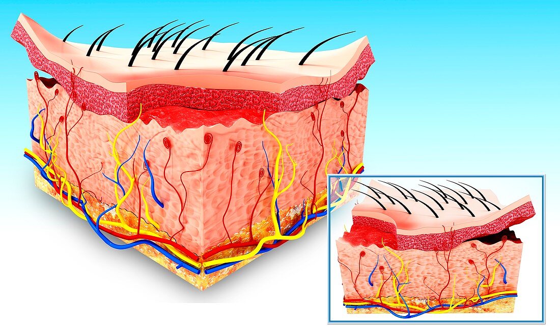 Human skin anatomy,artwork