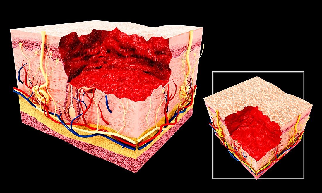 Human skin anatomy,artwork