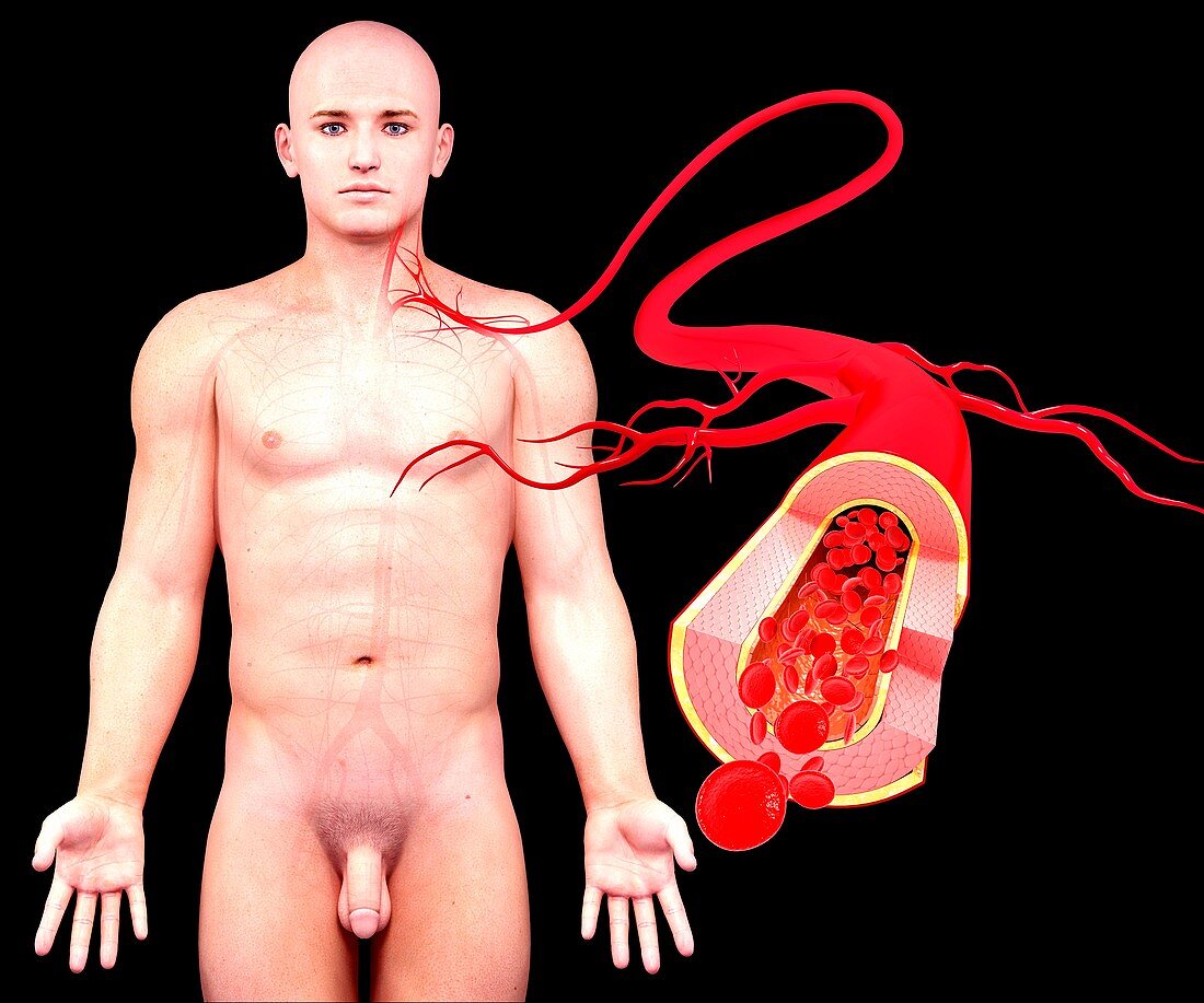 Human artery,artwork