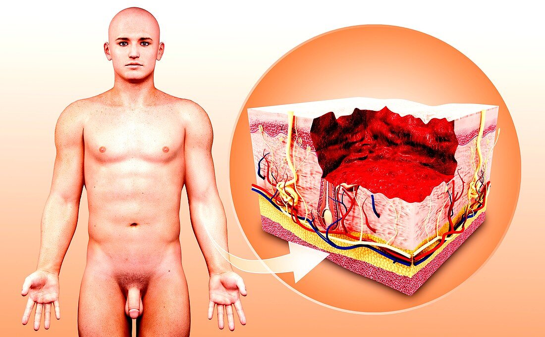 Human skin anatomy,artwork