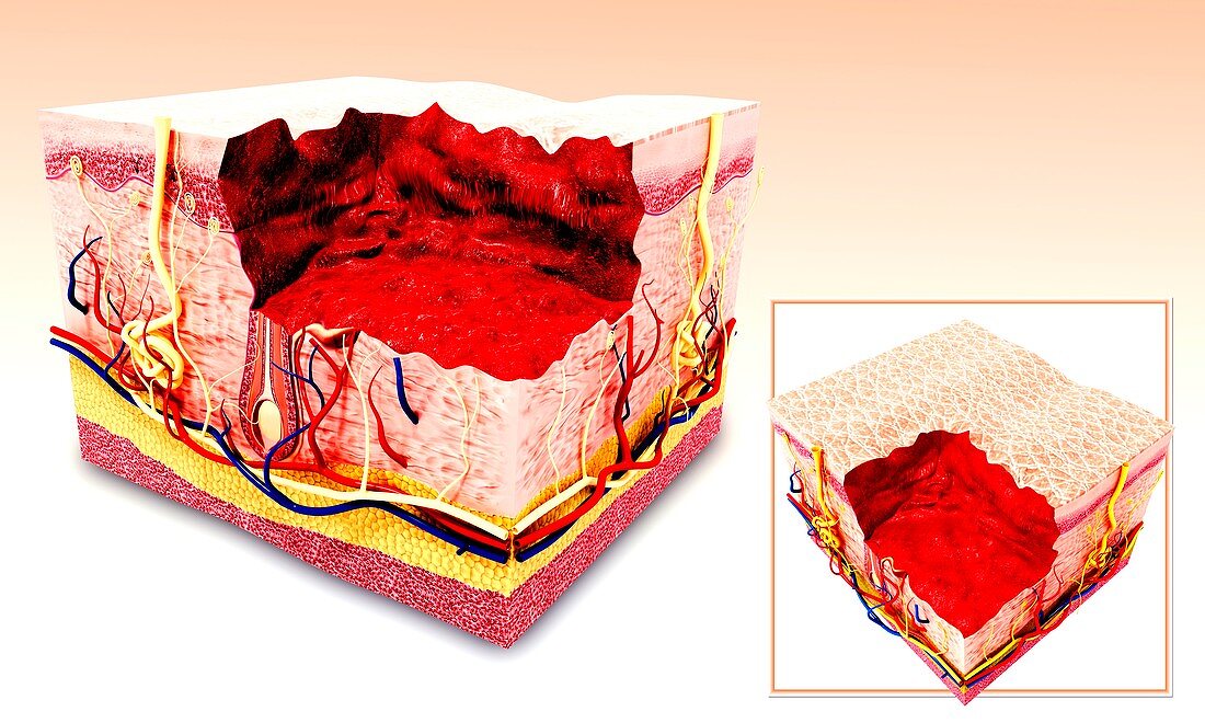 Human skin anatomy,artwork