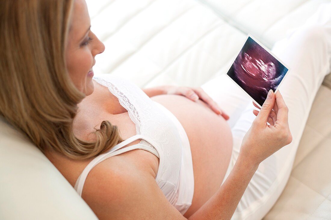 Pregnant woman with baby scan