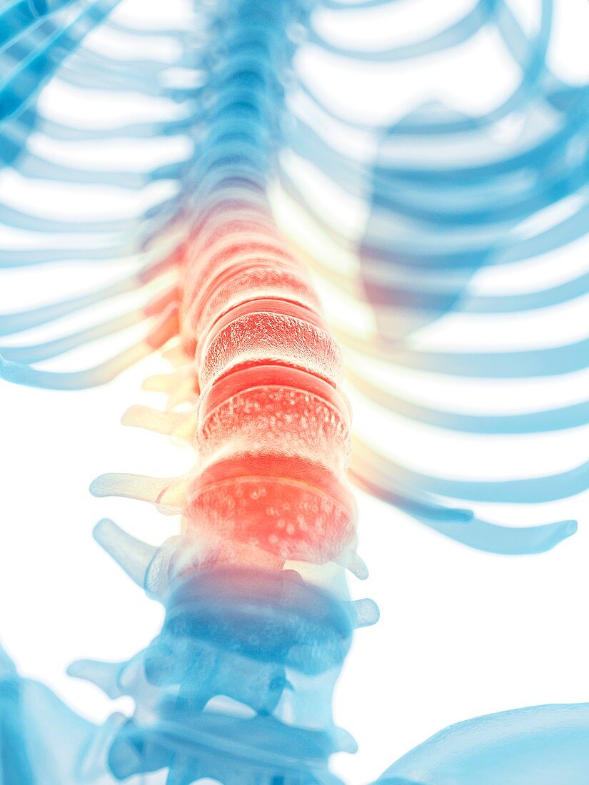 Human lumbar spine,artwork