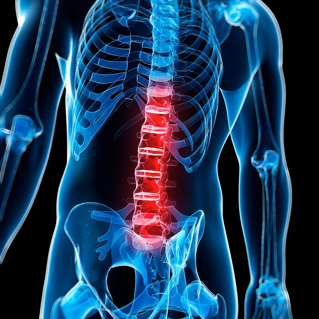Human back pain,artwork