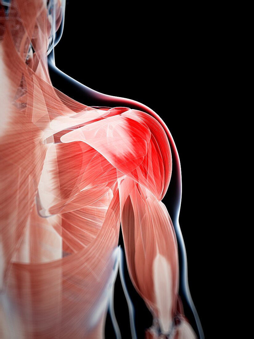 Human shoulder pain,artwork