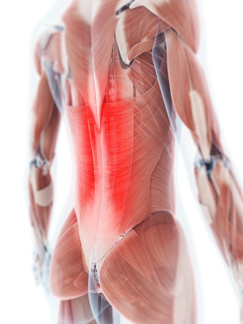 Human back muscle pain,artwork