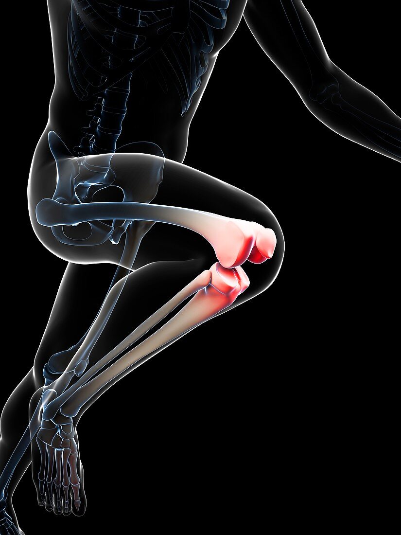 Runner's knee joint,artwork