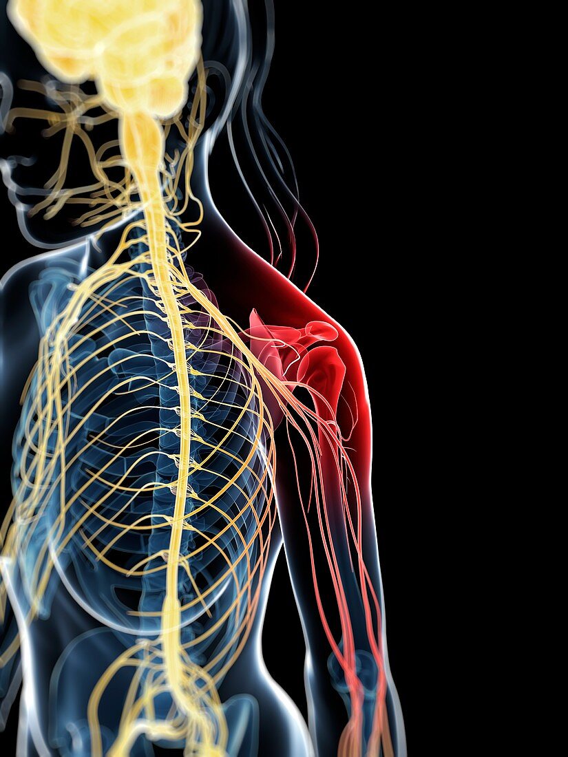 Human shoulder nerve pain,artwork