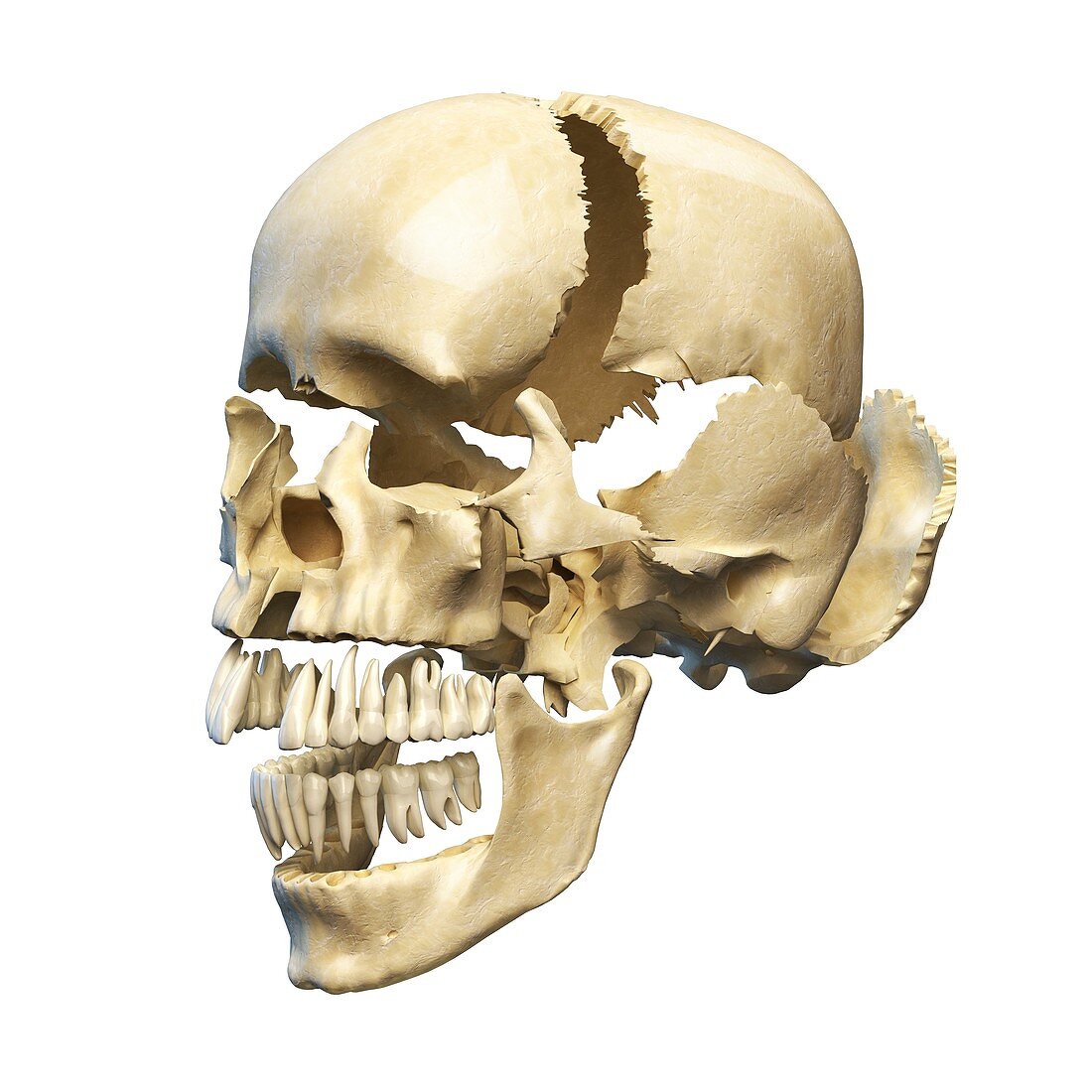 Human skull in sections,artwork