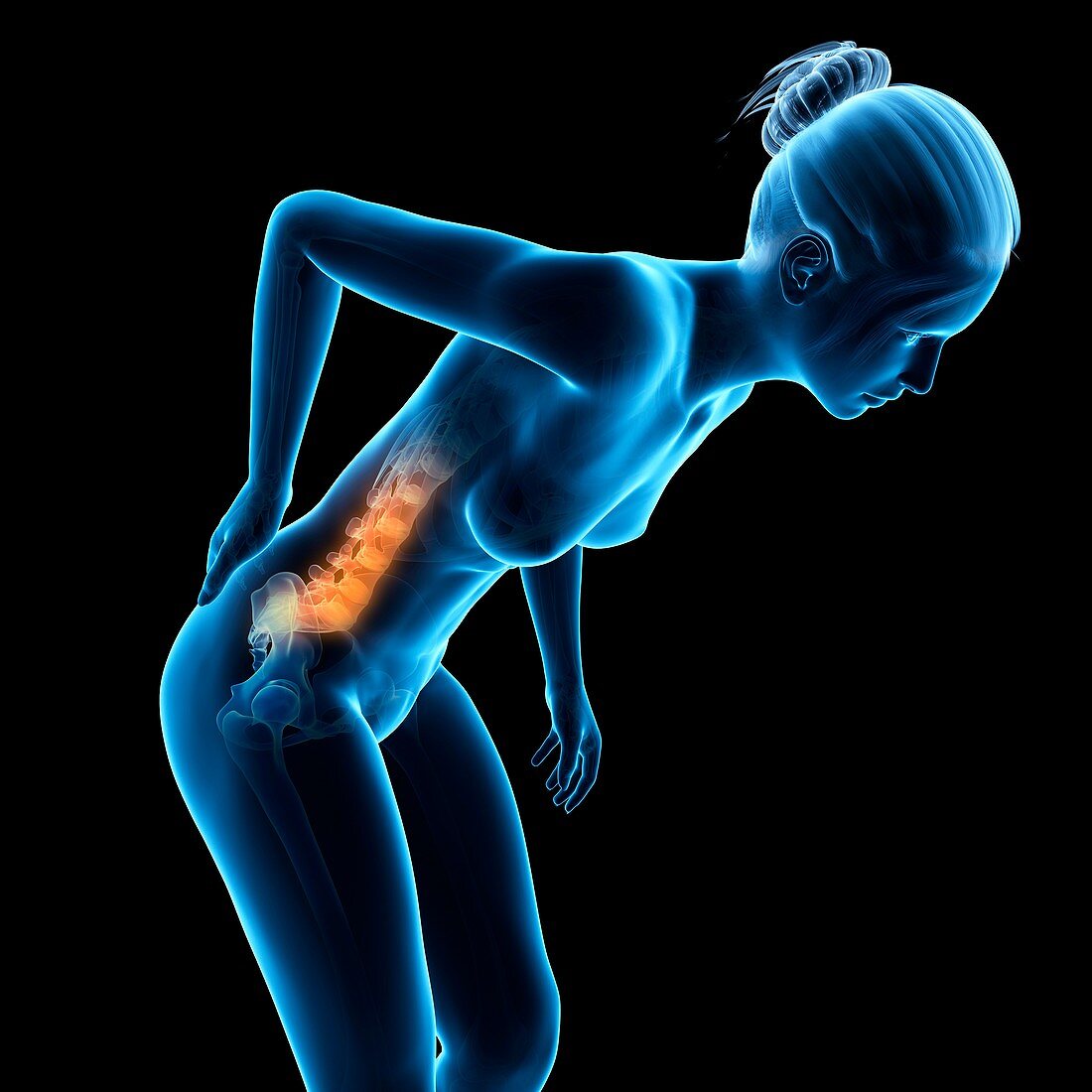Human back pain,illustration