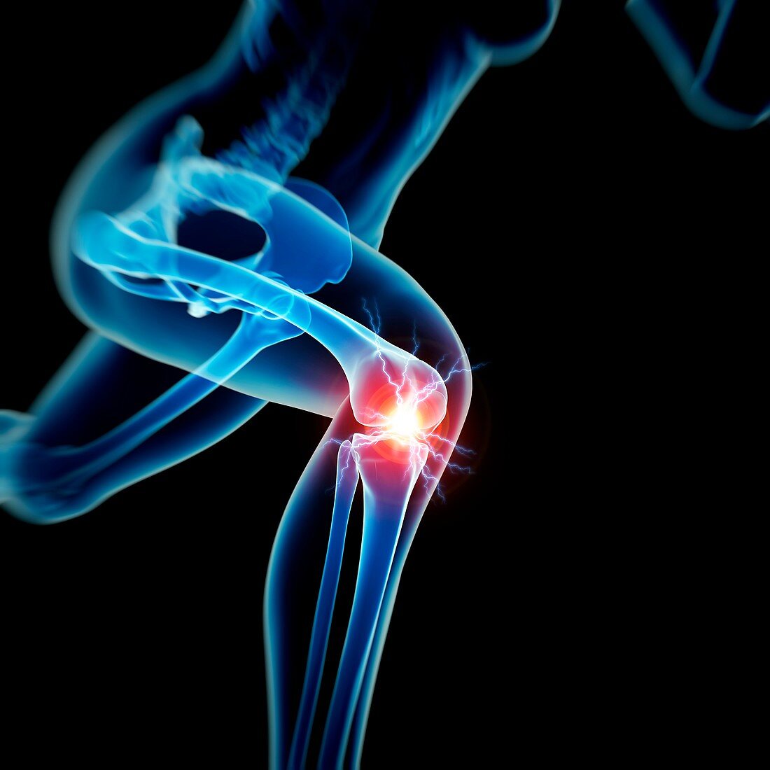 Human knee pain,illustration