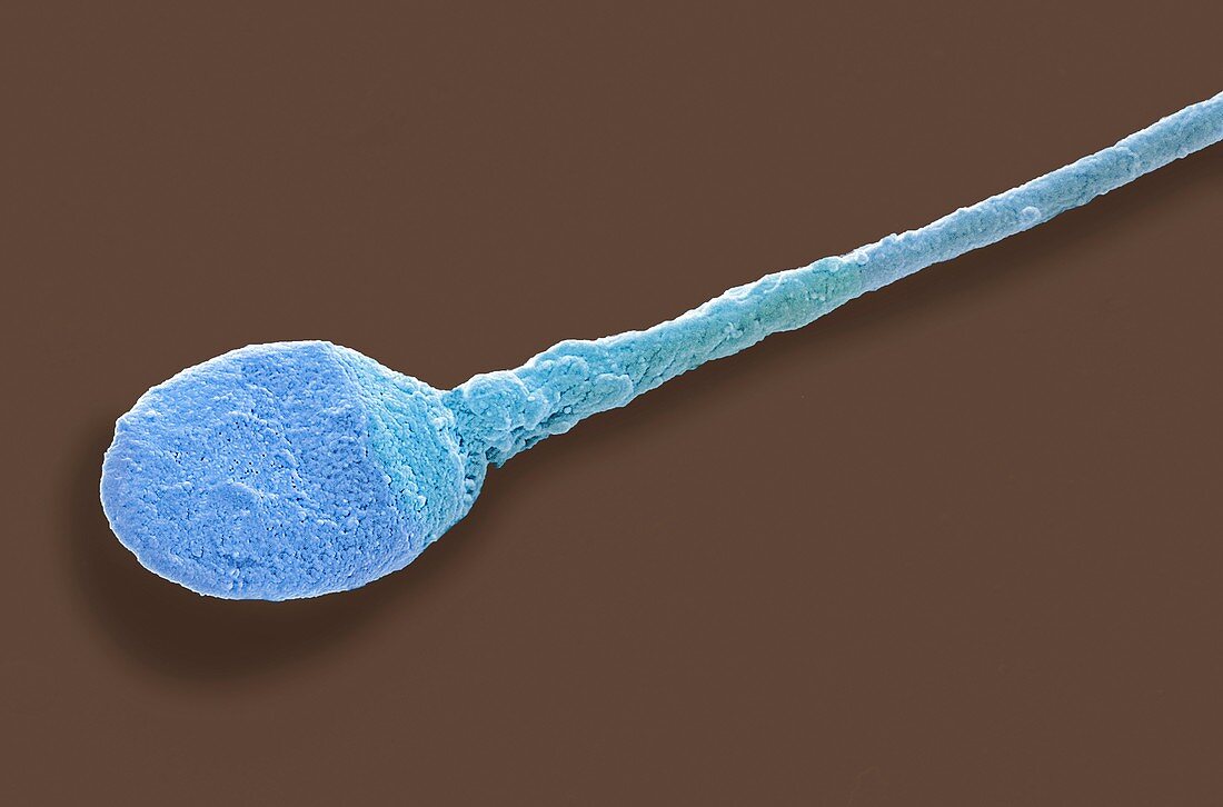 Human sperm cell,SEM