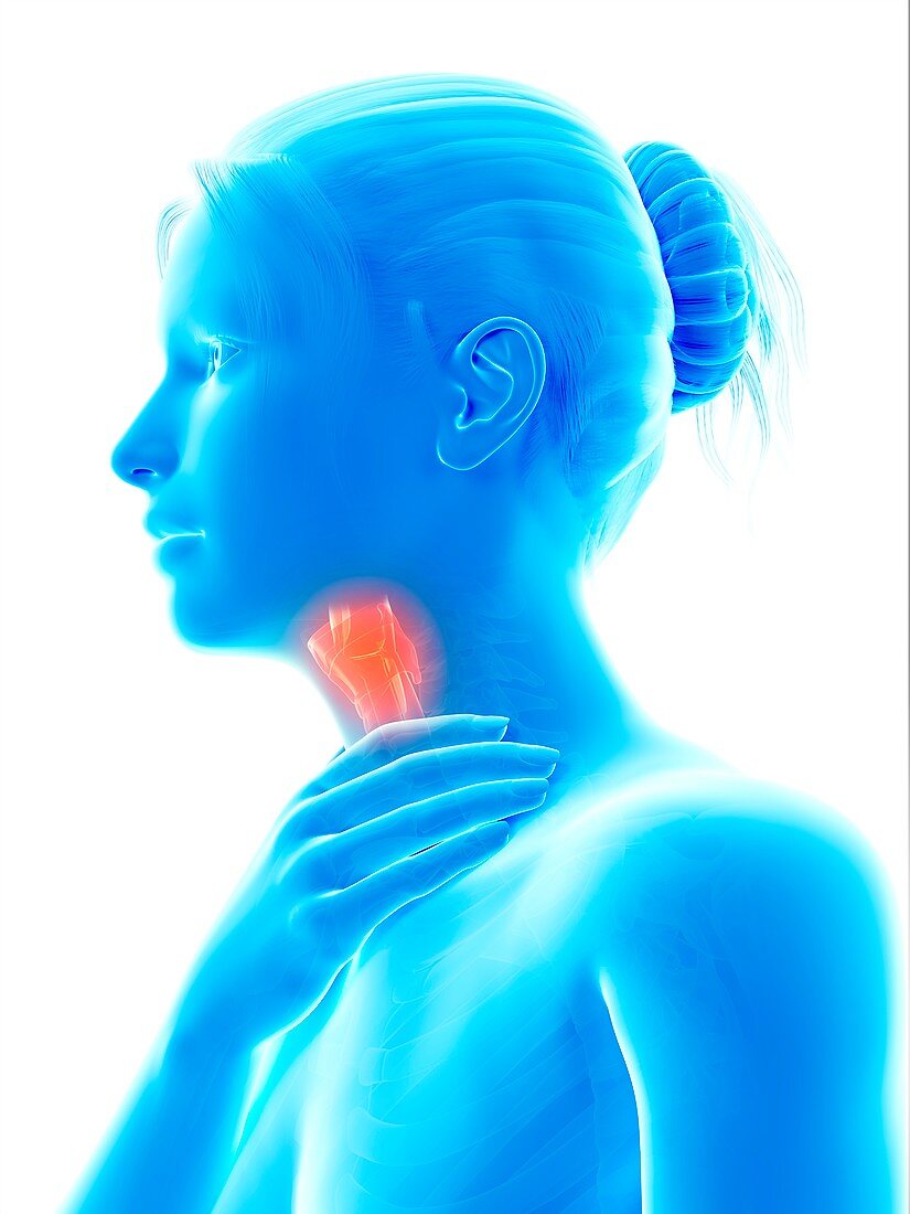 Inflammation of the larynx,illustration