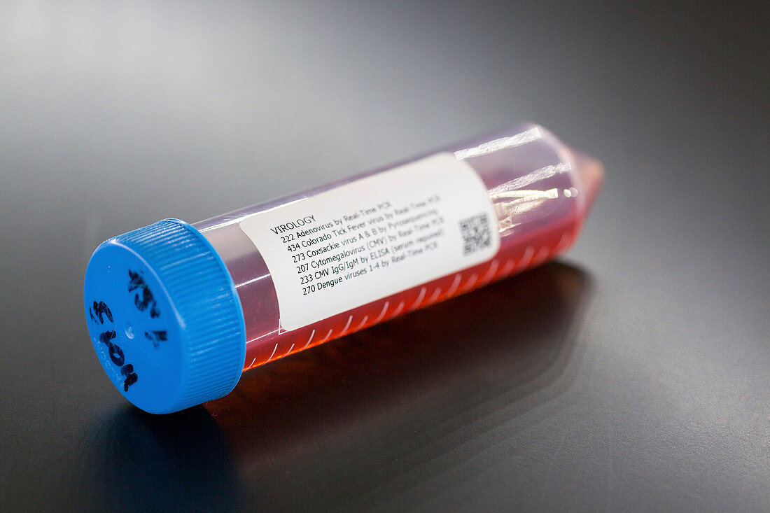 Test tube containing a blood sample
