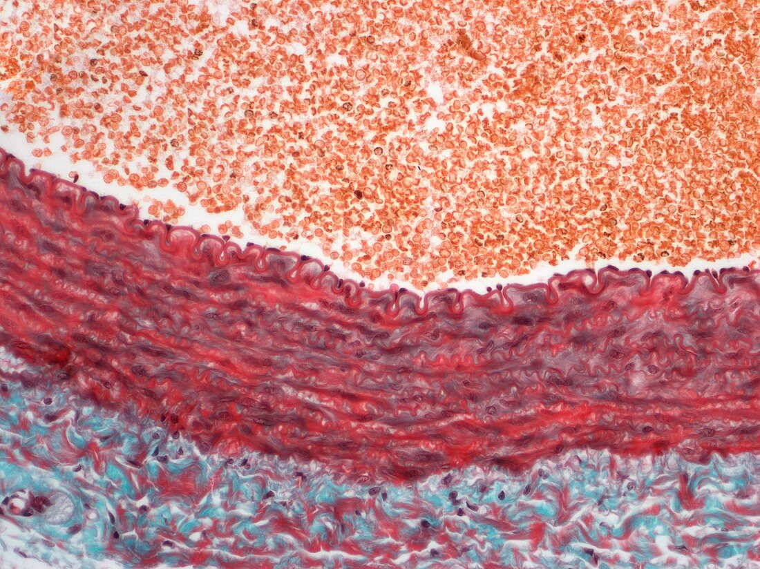 Artery,light micrograph