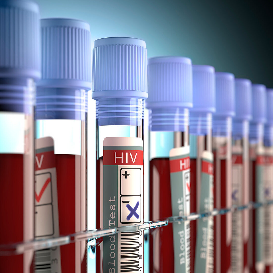 Blood samples for HIV tests,illustration