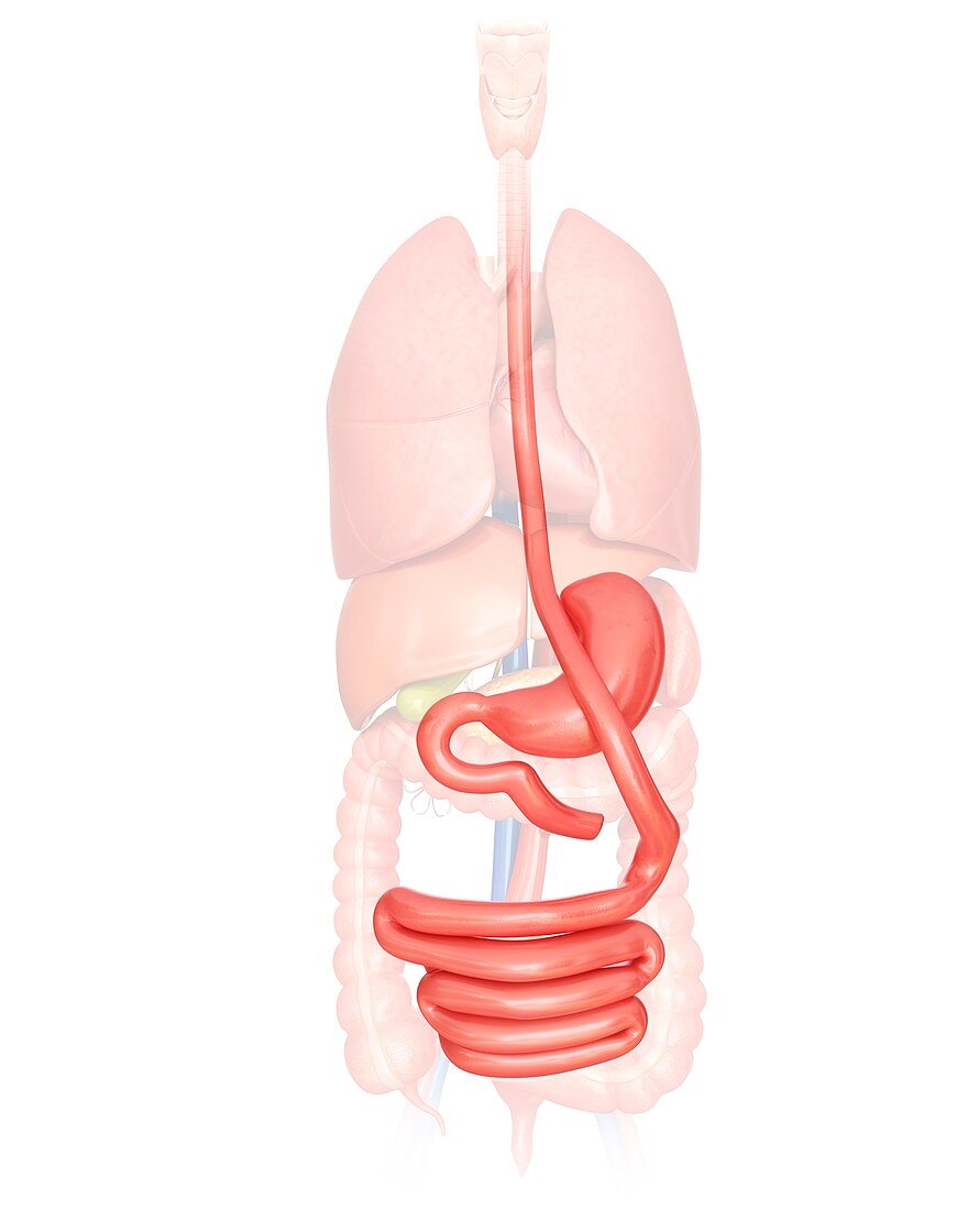 Gastric bypass,illustration