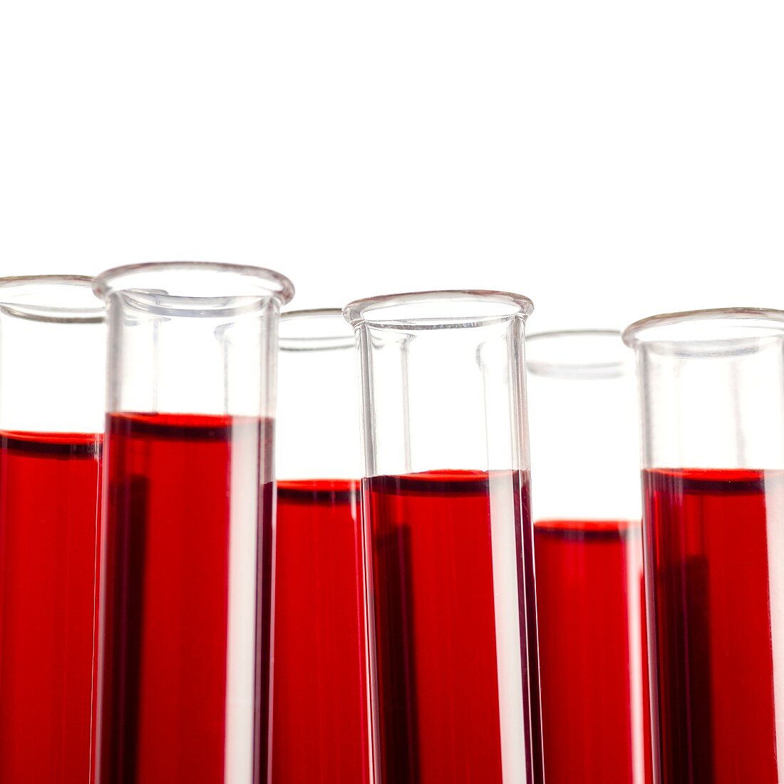 Blood samples in test tubes