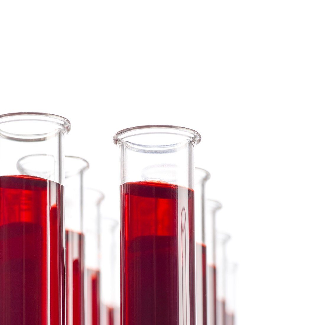 Blood samples in test tubes