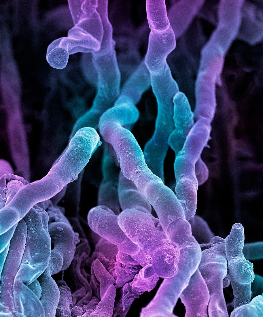Streptomyces coelicoflavus bacteria,SEM