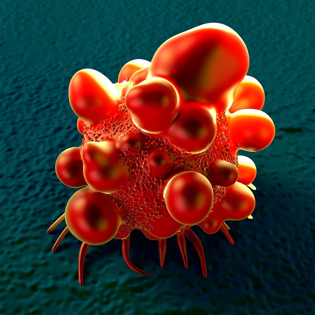 Bowel cancer cell,illustration