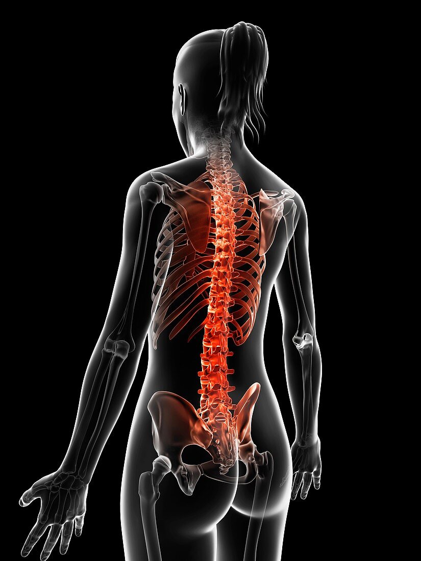 Human spine pain,Illustration