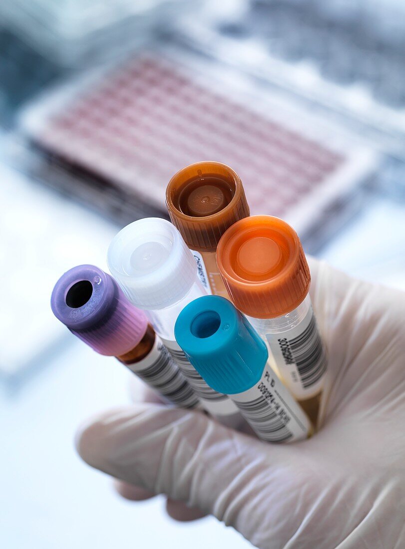 Blood and other samples for testing