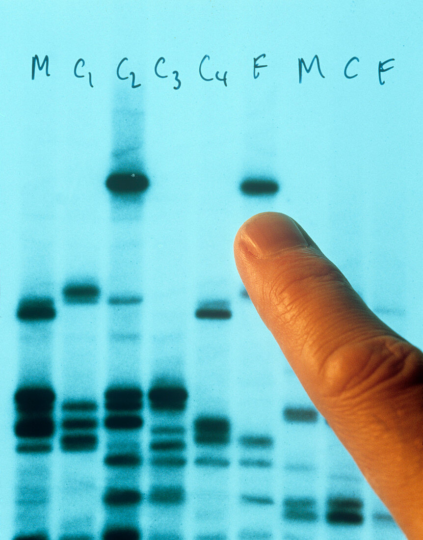 DNA fingerprinting used to prove paternit